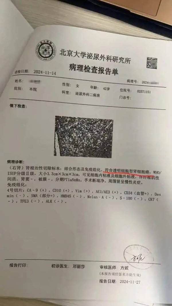配资炒股排名 体检10年未预警却患癌症，每年体检是否还有意义？